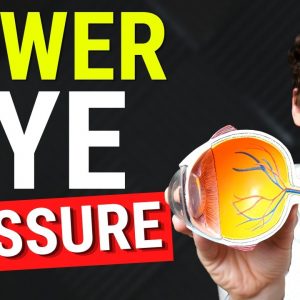 Natural Glaucoma Treatment for High Eye Pressure - How to Lower Eye Pressure Naturally