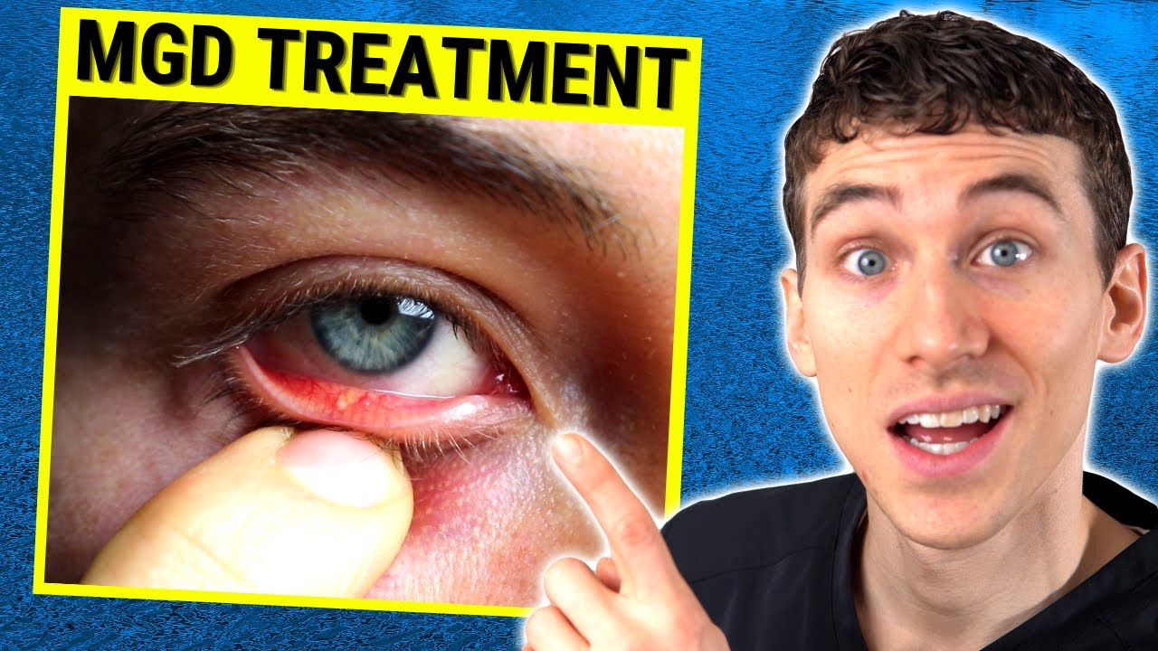 MGD Dry Eye Treatment Guide How To Treat Meibomian Gland Dysfunction MGD Dry Eye Treatment Guide How To Treat Meibomian Gland Dysfunction