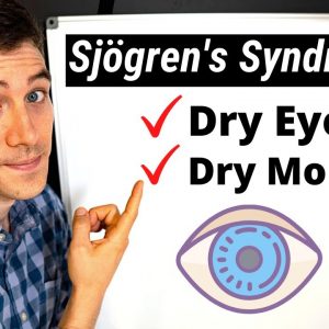 What is SjÃ¶gren's Syndrome? Eye Doctor Explains