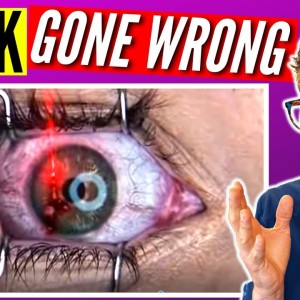 Doctor Reacts to Lasik Eye Surgery GONE WRONG!