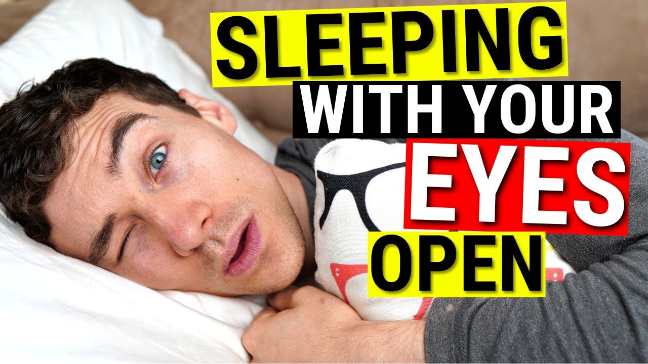 Sleeping With Eyes Open Dry Eye Treatments For Lagophthalmos