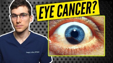 Eye Cancer? Eye Freckle Vs Melanoma of the Eye