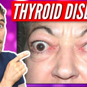 7 Signs of Thyroid Eye Disease and Graves Disease